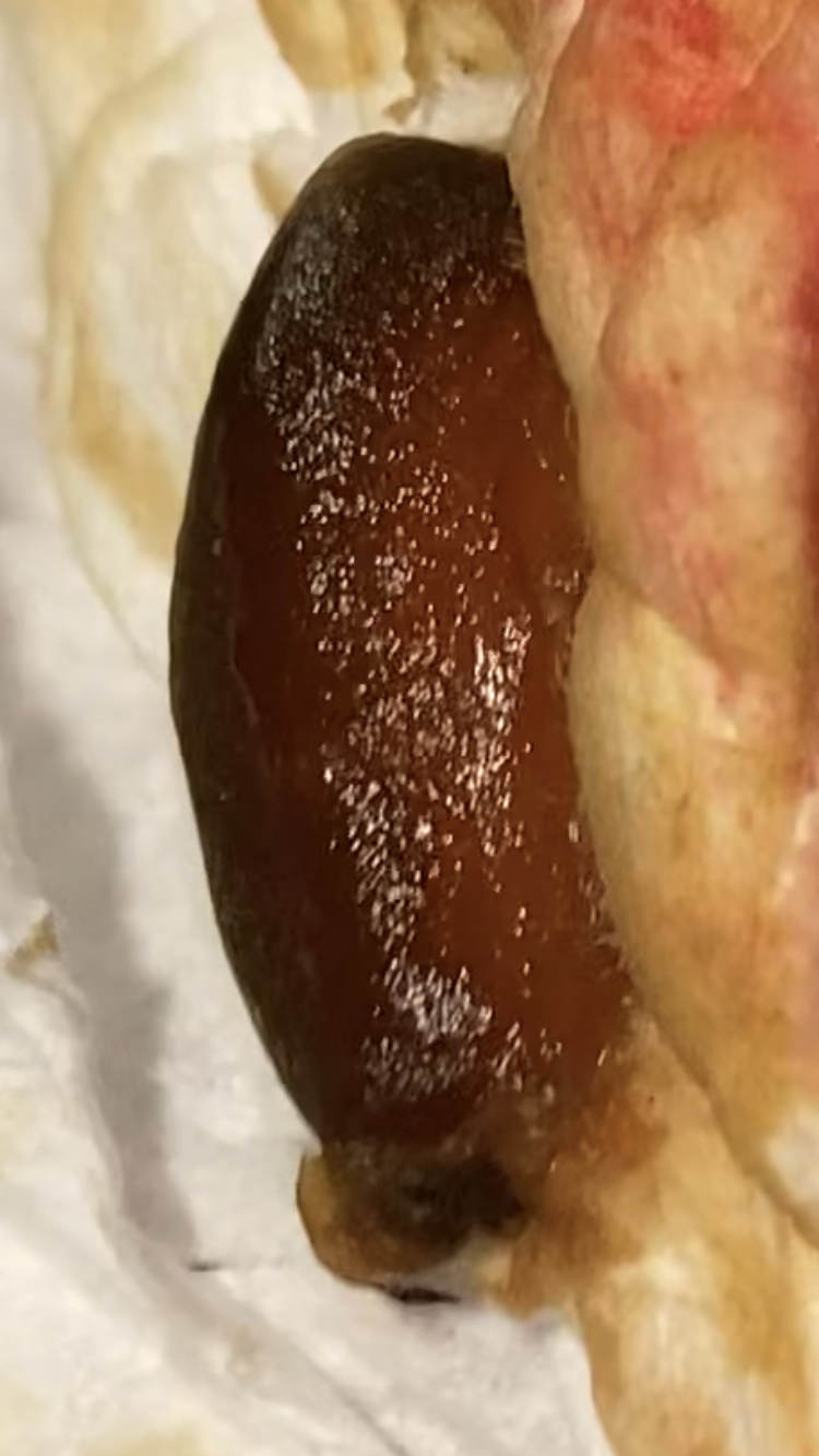 Liver Fluke Documentation - Rectal Expulsion